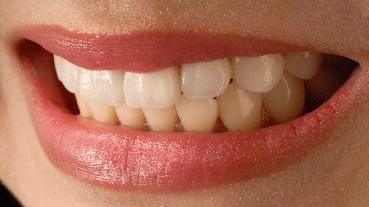 Krzywe akcje przy prostowaniu zębów. Dr Smile z zarzutami