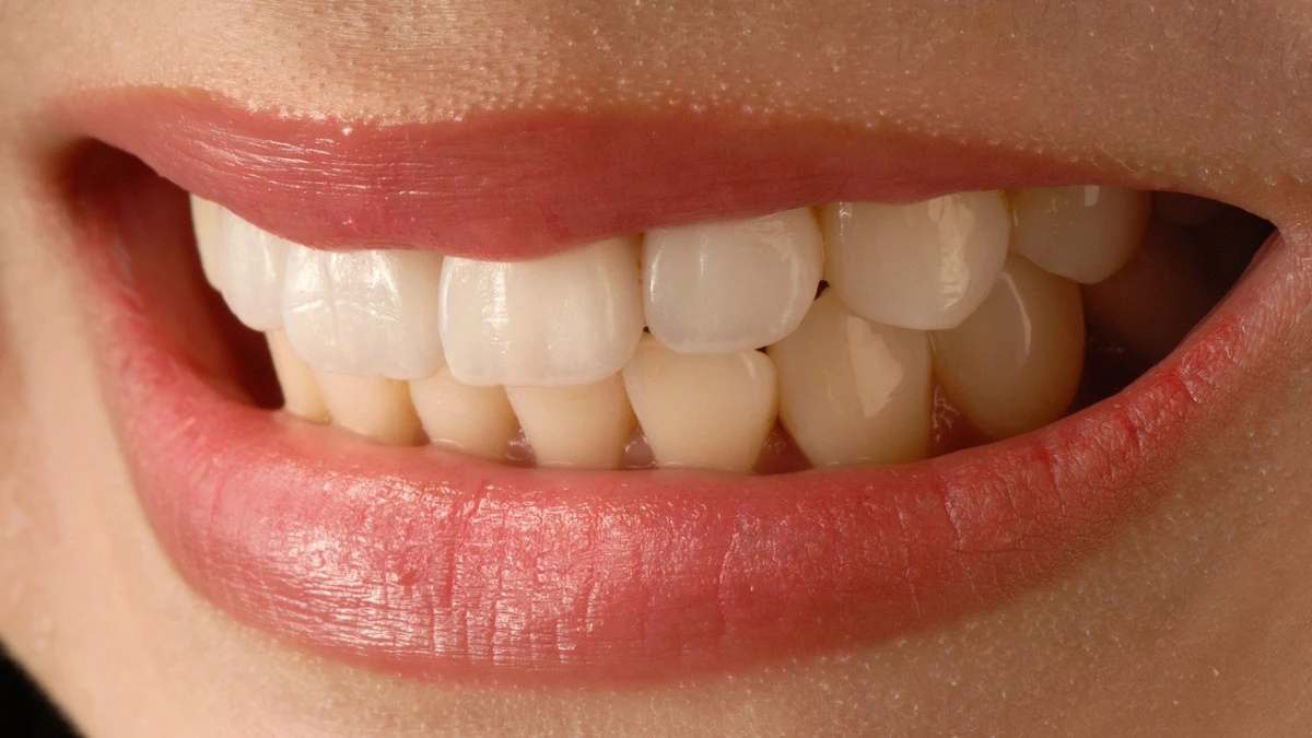 Krzywe akcje przy prostowaniu zębów. Dr Smile z zarzutami