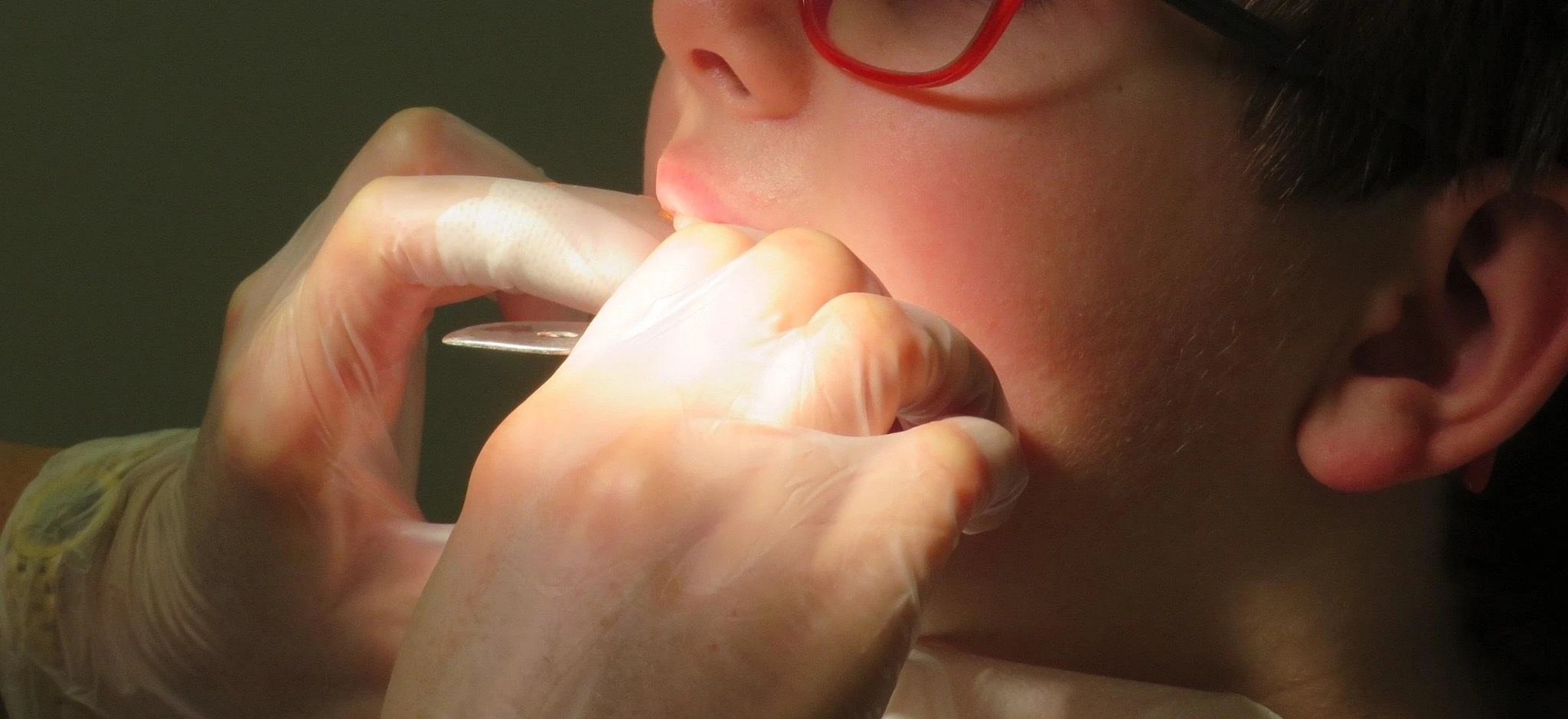 Leczenie u dentysty można odpisać od podatku? Jest decyzja skarbówki