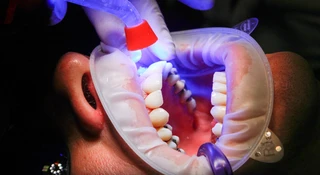 Chciał odliczyć równe zęby od podatku. Cios fiskusa w szczękę