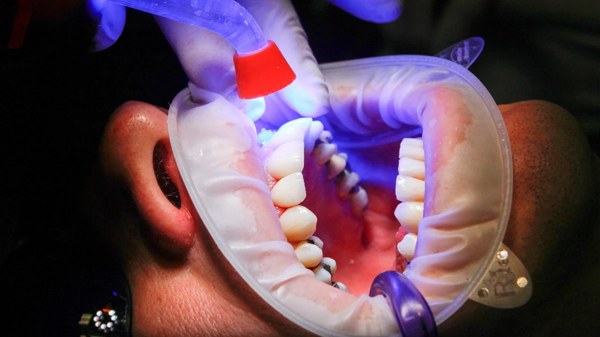 Chciał odliczyć równe zęby od podatku. Cios fiskusa w szczękę